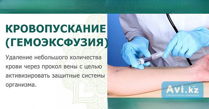 Венозное кровопускание при отеках ног к вечеру Алматы - изображение 1