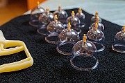 Хиджама для здоровья и баланса организма/wet cupping Almaty Алматы