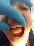 Круглосуточная стоматология в Алматы Алматы