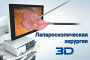 3D Лапароскопия Алматы хирург Игорь Никонов Алматы