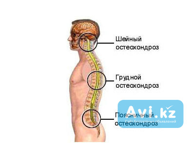 Проф массаж стаж 13 лет Астана - изображение 1