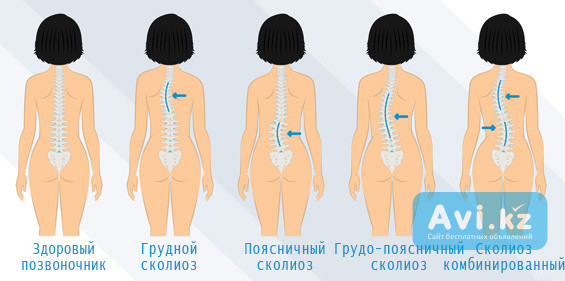 Лечебный массаж для позвоночника Алматы - изображение 1