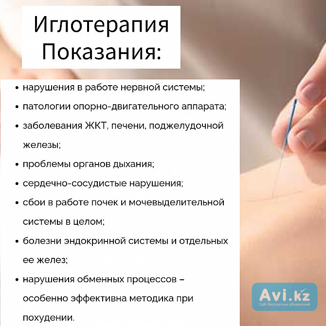 Иглоукалывание, иглотерапия, иглорефлексотерапия, акупунктура Алматы - изображение 1