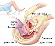 Гинекологический массаж, массаж матки, обучение Алматы