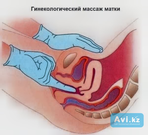 Профессиональное обучение гинекологическому массажу: 110 000 тг Алматы - изображение 1
