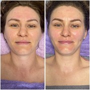 Массаж лица глубокий лифтинг-дренажный Алматы