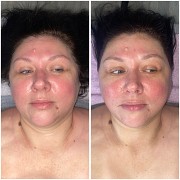 Массаж лица глубокий лифтинг-дренажный Алматы