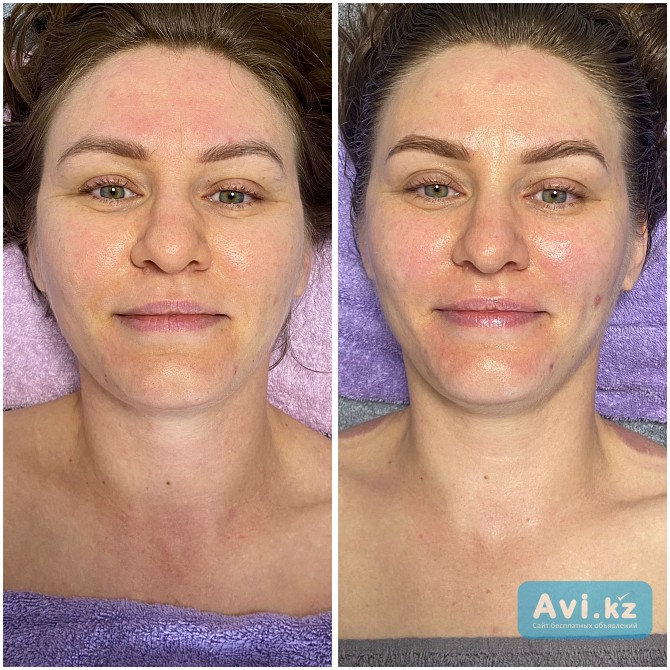 Массаж лица глубокий лифтинг-дренажный Алматы - изображение 1