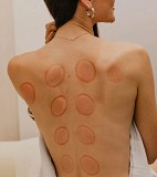 Астана| Терапия Астана