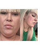 Эндолиф Усть-Каменогорск