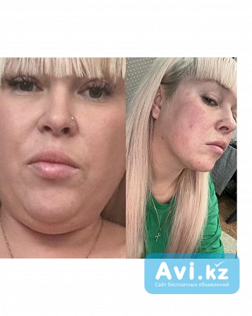 Эндолиф Усть-Каменогорск - изображение 1