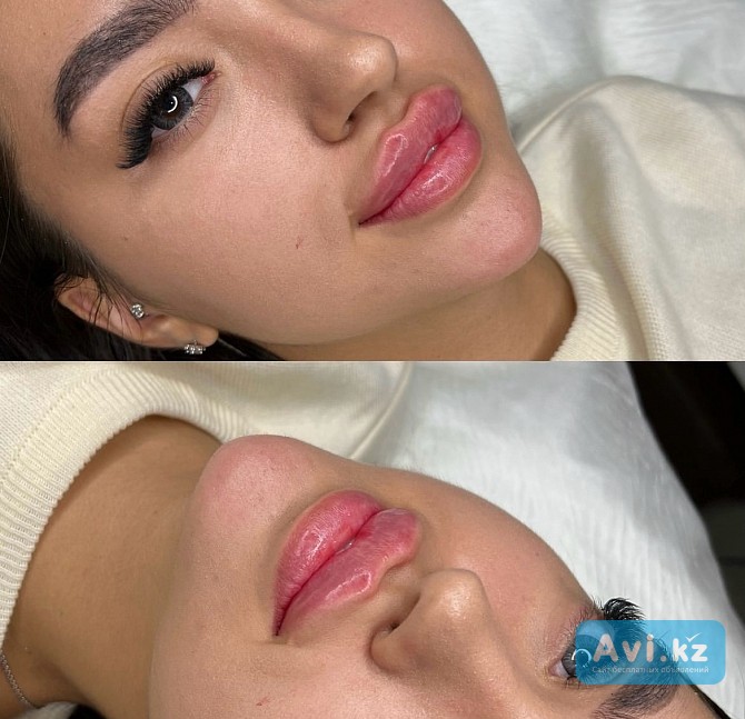 Косметолог увеличение губ Алматы - изображение 1